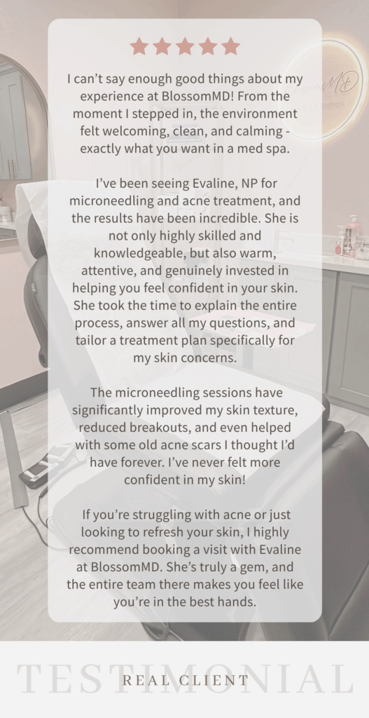 microneedling for acne scars San Ramon, East Bay