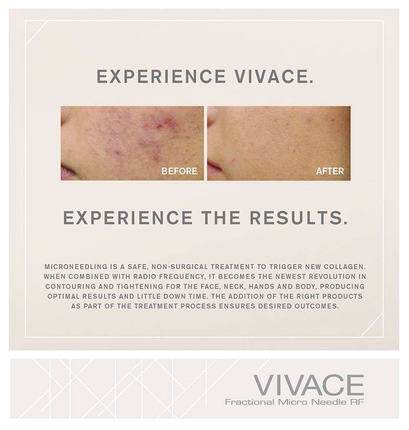 Vivace