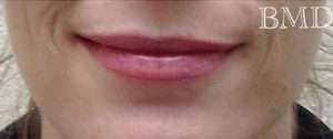 Permanent Makeup Before & After Photos