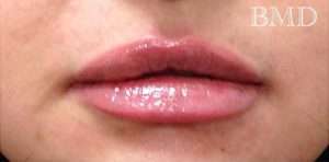 Permanent Makeup Before & After Photos
