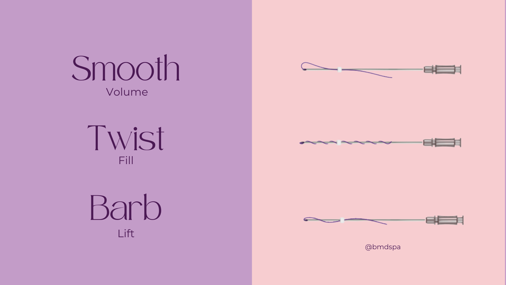 3 Types of PDO Threadlift