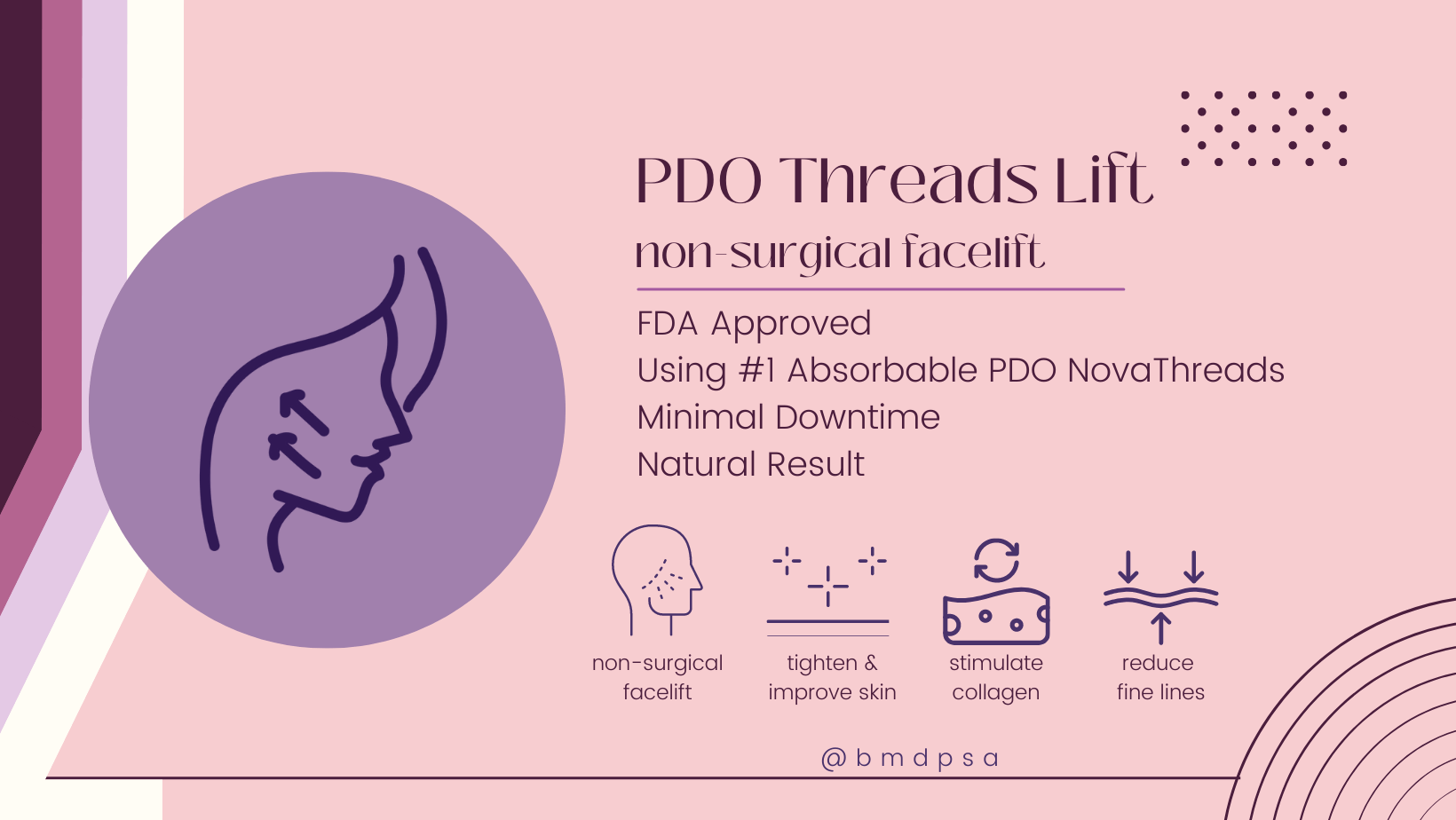 PDO Threads Lift - Non Surgical Facelift