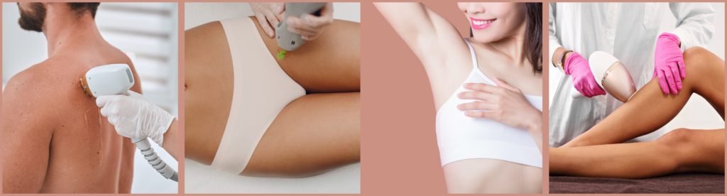 Laser-Hair-Removal-BlossomMD-East-Bay-California