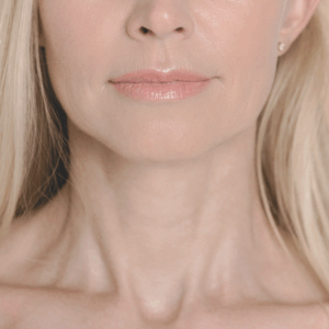 Don’t Forget the Neck: Skincare Tips to Prevent Wrinkles & Tech Neck 1 neck skincare teck neck BlossomMD San Ramon