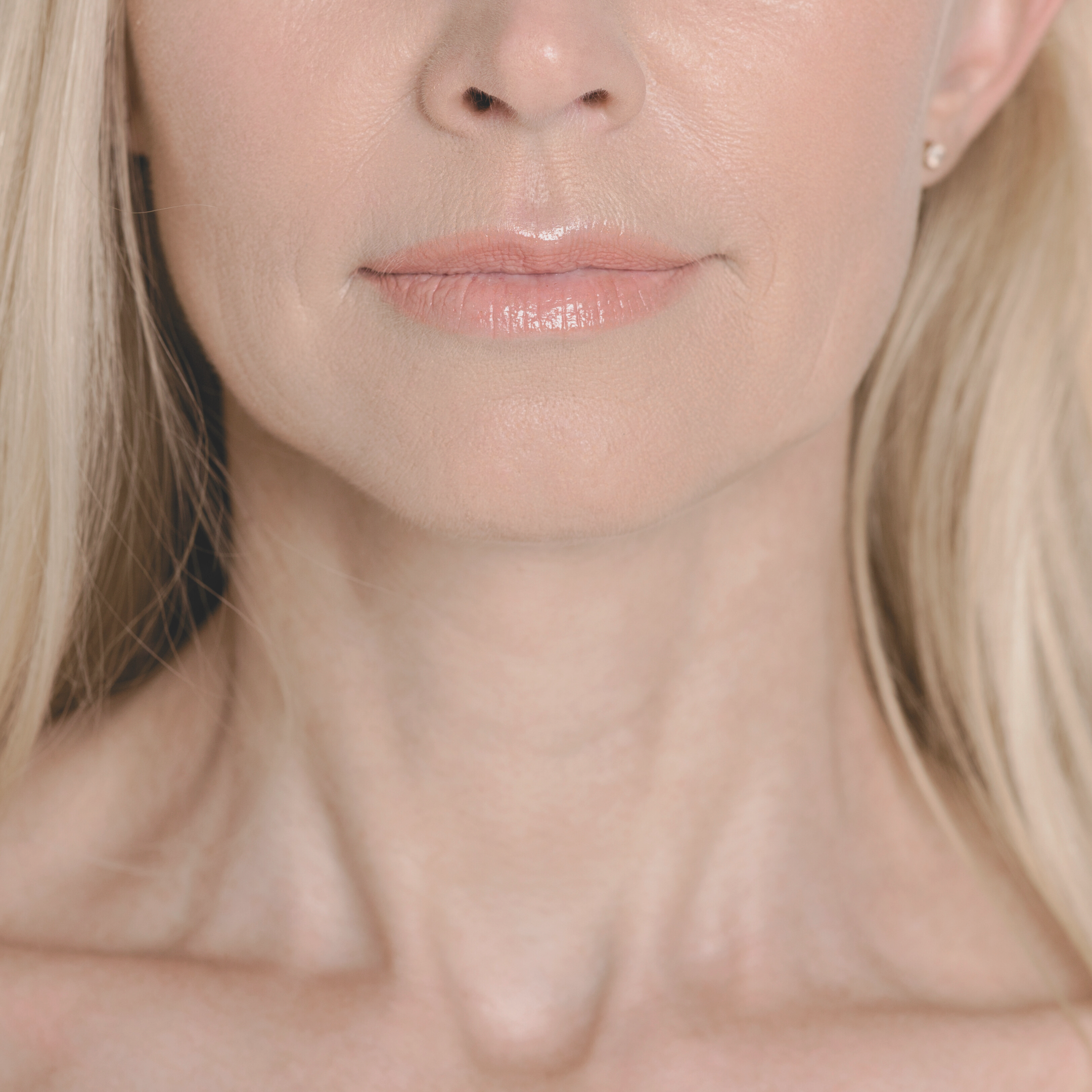 neck skincare teck neck BlossomMD San Ramon