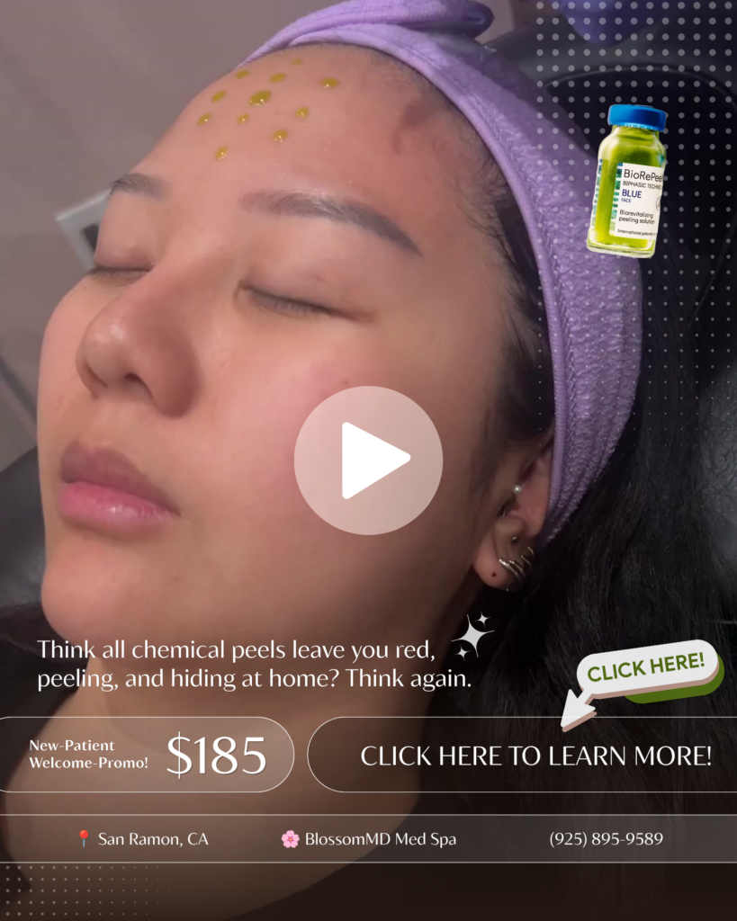 Click-to-learn-more-BioRePeel-no-peel-chemical-peel-San-Ramon-CA-BlossomMD-Med-Spa.