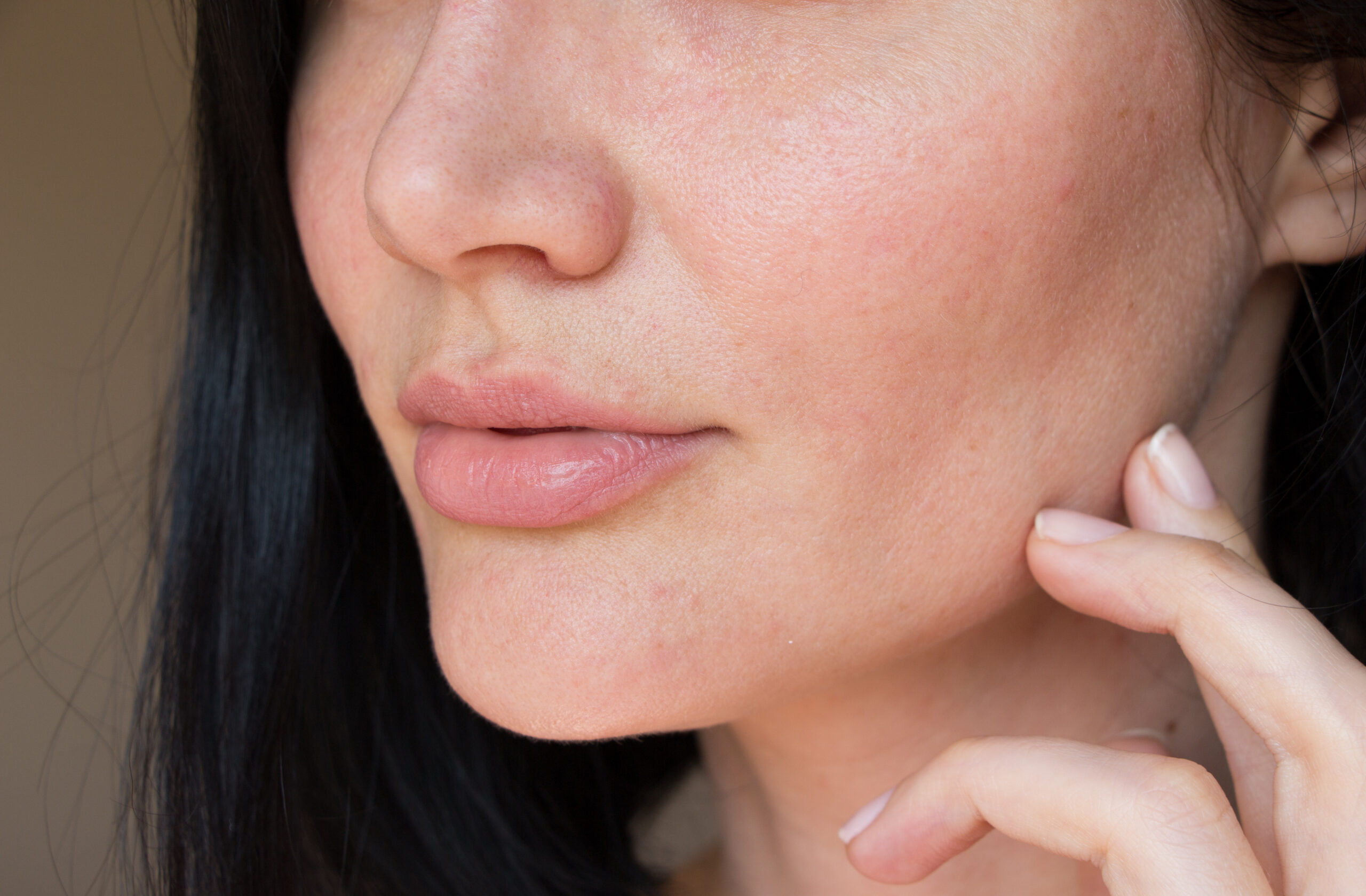 Women Textured Skin