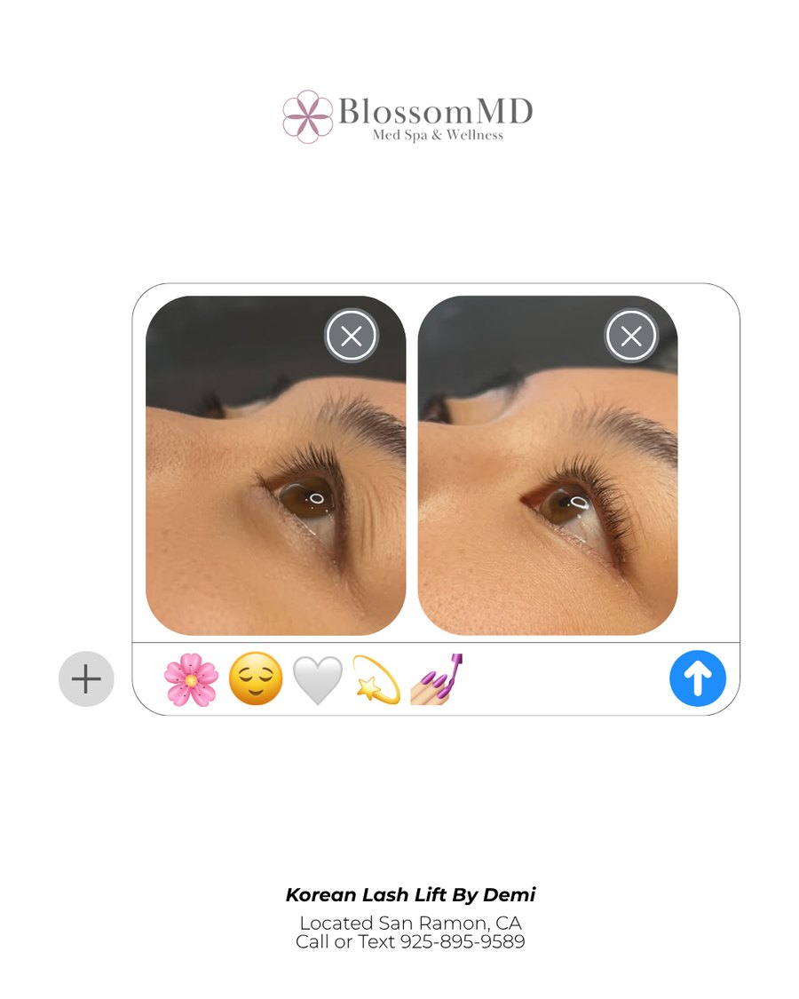 Before and after Korean Lash Lift and Keratin Lash Lift at BlossomMD